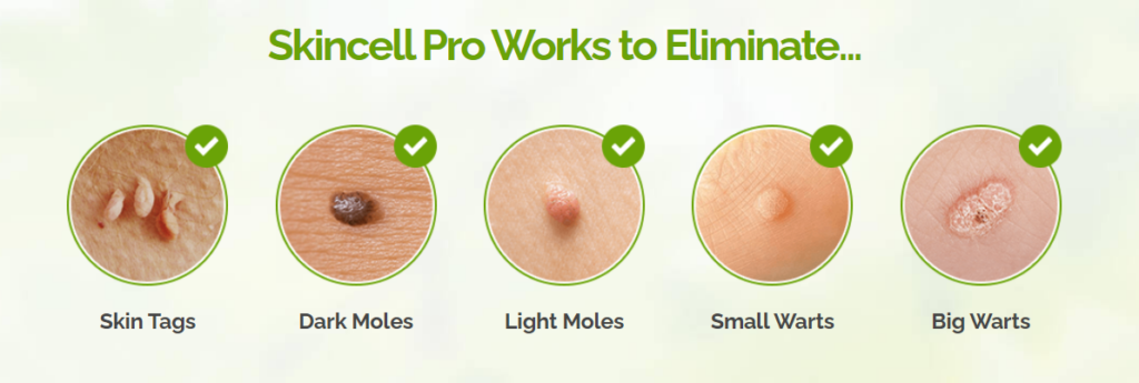 skincell 3